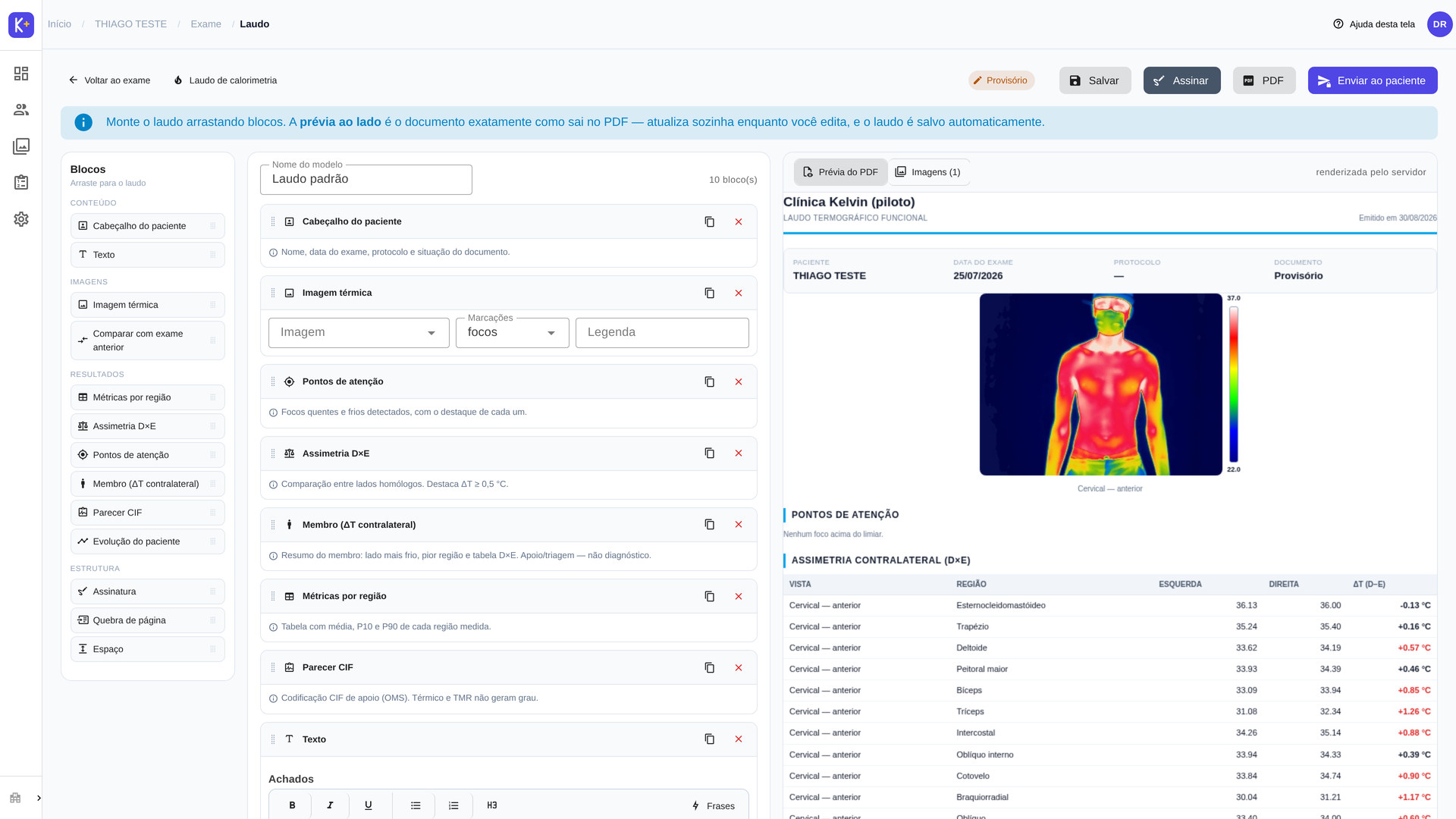 Editor de laudo com prévia A4 e bloco de assimetria D×E.